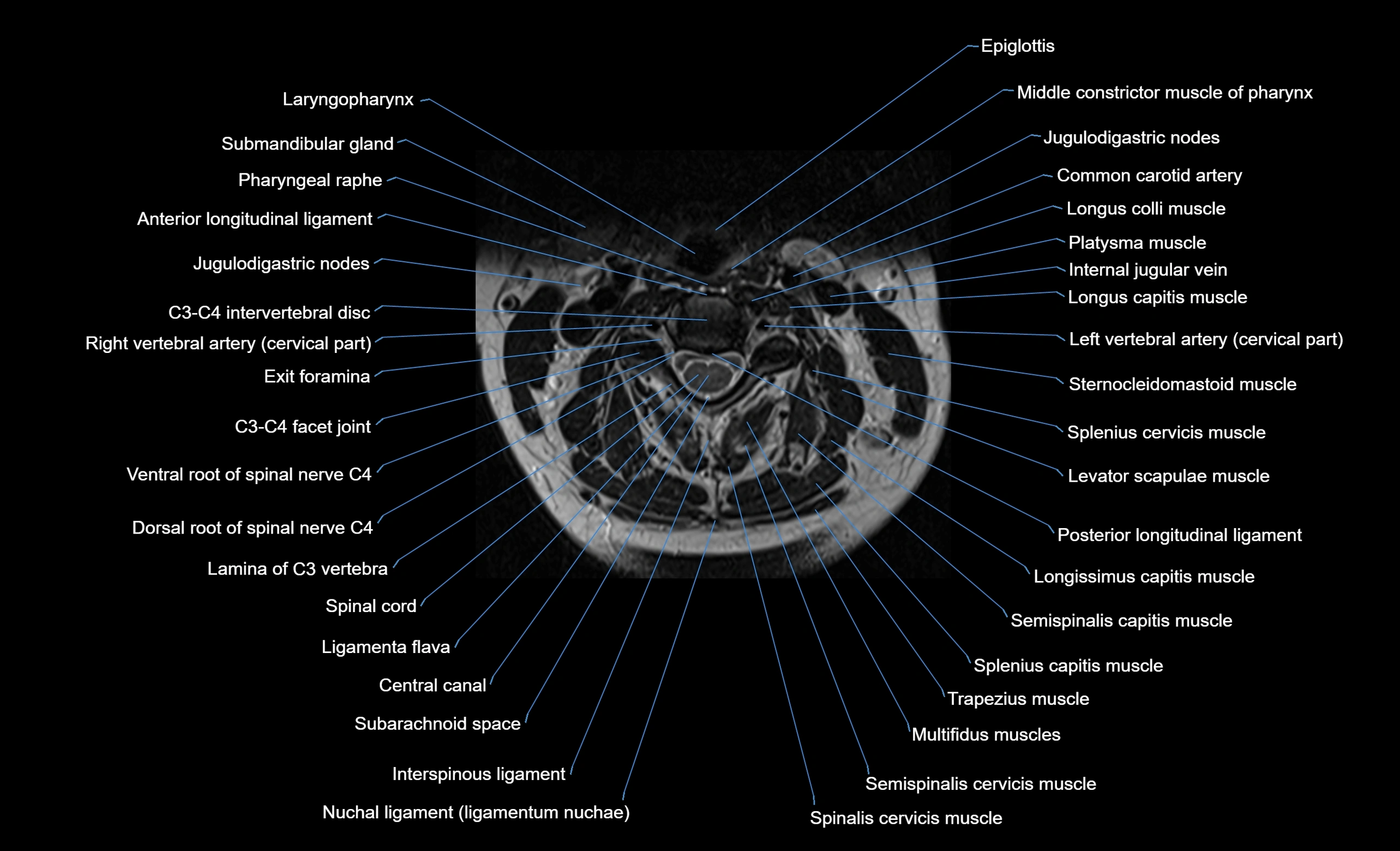cervical spine cross sectional MRI anatomy  3T MRI axial  image-img-00001-00018.webp